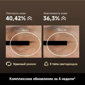 Светодиодная маска Dreame Chrona Pro фото